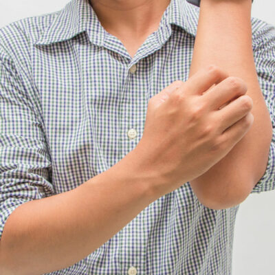 Eczema – Signs, Symptoms, and Home Remedies