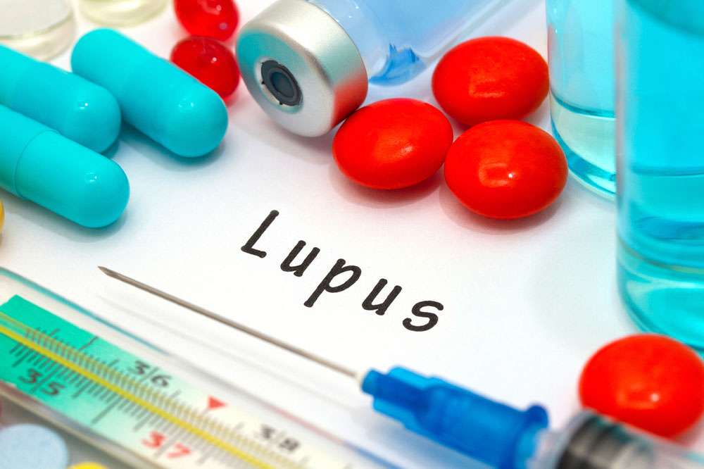 Lupus – Types and Warning Signs